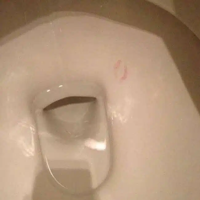 Embrasser des toilettes